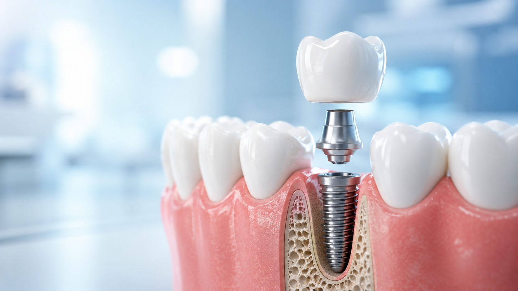 Dental clinic in Virugambakkam, Chennai - modern dental care